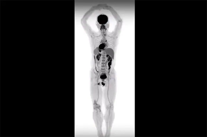 Explorer, lo scanner 3D del corpo umano: rivoluzione nel campo medico